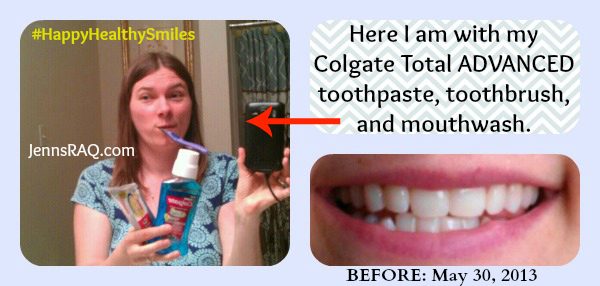 Preventing Cavities with Clean Teeth #HappyHealthySmiles